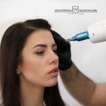 Лазерное удаление татуажа в Ярославле, в Ярославле