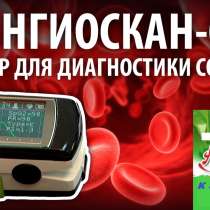 АнгиоСкан 01П – портативный прибор для диагностики состояния, в г.Буча