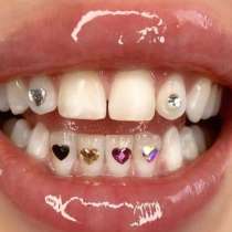 Скайсы, в Липецке