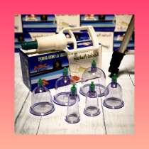 Вакуумные банки, в Санкт-Петербурге