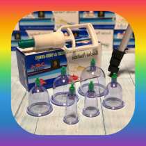 Вакуумные банки, в Санкт-Петербурге