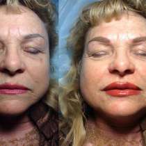 Микроблейдинг, в Москве