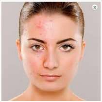 Aronia berry extract, в г.Киев