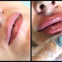 Увлажнение губ, в Москве